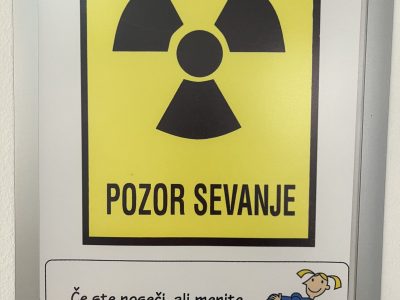 rendgensko slikanje pljuc